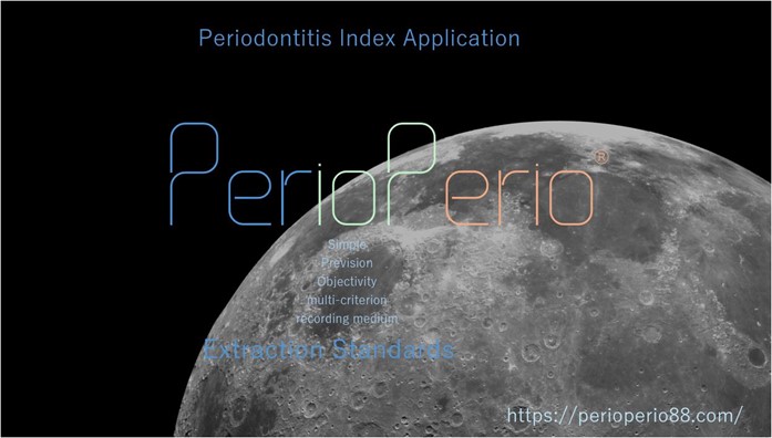 PerioPerio